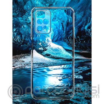 Xiaomi Redmi Note 10 POCO M3 Pro Kamera Korumalı Shockproof Silikon Kılıf